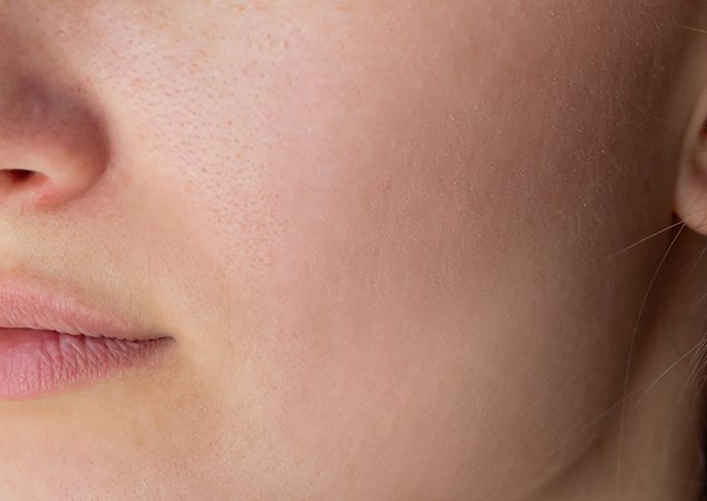 transformation-img-2