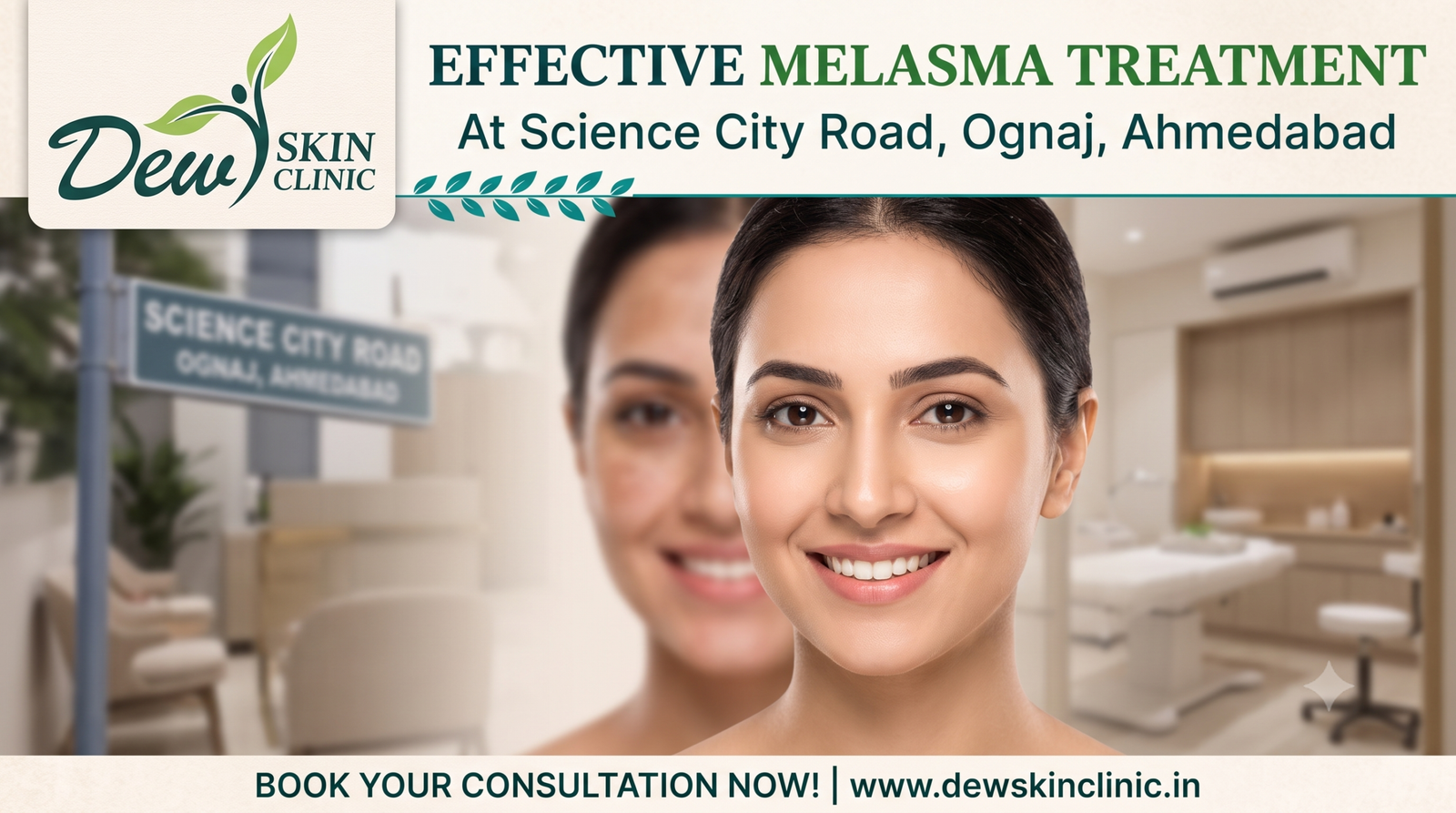 Melasma Treatment in Science City Road Ognaj, Ahmedabad: Causes, Options and Expert Care at Dew Skin Clinic
