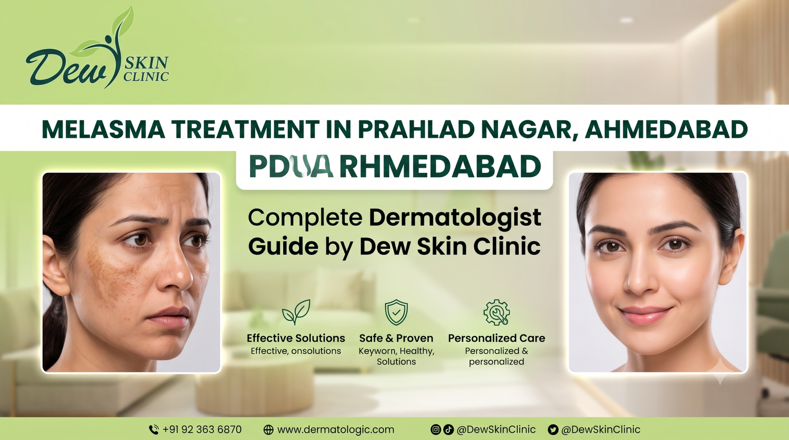Melasma Treatment in Prahlad Nagar, Ahmedabad: Complete Dermatologist Guide by Dew Skin Clinic